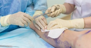 rééducation après phlébectomie